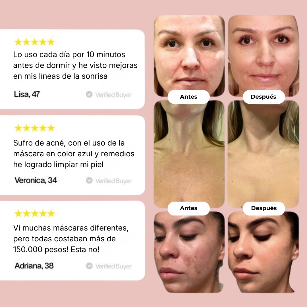 Therapy Mask Gloomu™